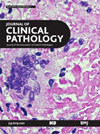 JOURNAL OF CLINICAL PATHOLOGY封面